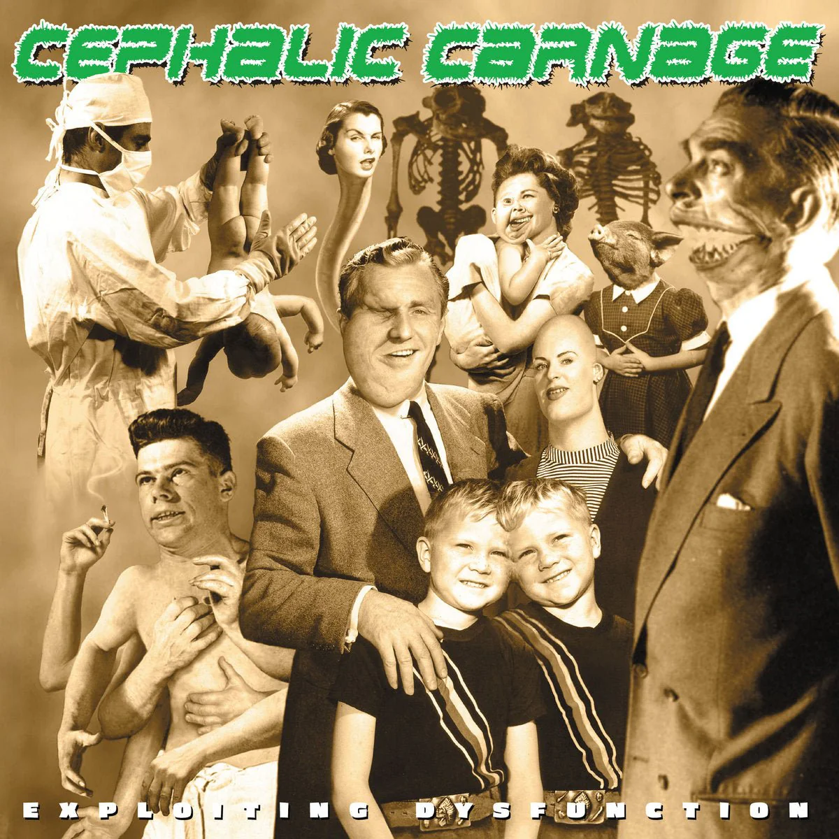 CEPHALIC CARNAGE "Exploiting Dysfunction (Deluxe 25th Anniversary Reissue)" 2xLP